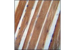 Immunohistochemistry analysis in formalin fixed and paraffin embedded human skeletal muscle reacted with NDUFA11 Antibody (Center) followed which was peroxidase conjugated to the secondary antibody and followed by DAB staining. (NDUFA11 antibody  (Middle Region))