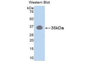 Western Blotting (WB) image for anti-Protein Kinase C, beta 1 (Pkc beta 1) (AA 342-600) antibody (ABIN3207327) (Pkc beta 1 antibody  (AA 342-600))