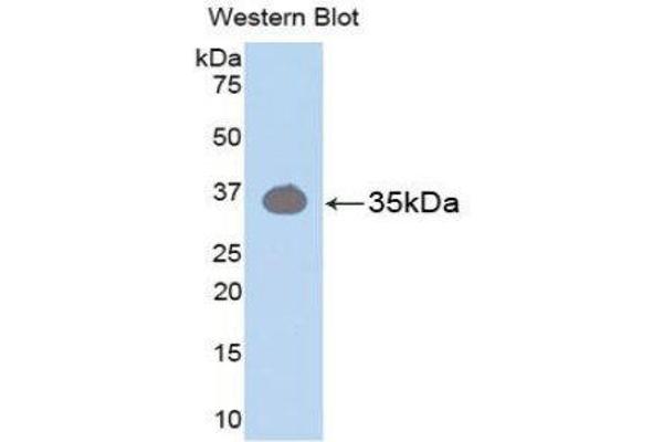 Pkc beta 1 抗体  (AA 342-600)