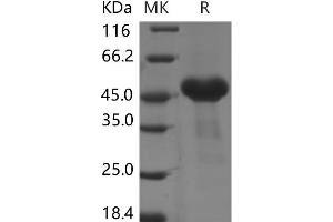 Western Blotting (WB) image for Cysteine-Rich with EGF-Like Domains 1 (CRELD1) protein (His tag) (ABIN7320036) (CRELD1 Protein (His tag))