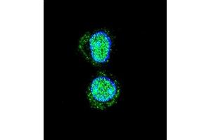 Confocal immunofluorescent analysis of HOXA10 Antibody (Center) (ABIN654234 and ABIN2844067) with HepG2 cell followed by Alexa Fluor 488-conjugated goat anti-rabbit lgG (green).