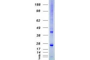 Validation with Western Blot