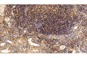 Immunohistochemistry (IHC) image for anti-Interleukin 17 (IL17) (AA 21-153) antibody (ABIN7427654)