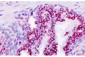 Human, Prostate: Formalin-Fixed Paraffin-Embedded (FFPE) (APRT antibody  (AA 149-179))