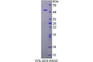 Image no. 1 for Smoothelin (SMTN) (AA 742-906) protein (His tag,GST tag) (ABIN6236924) (Smoothelin Protein (SMTN) (AA 742-906) (His tag,GST tag))