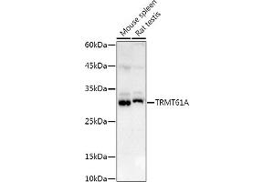 TRMT61A antibody  (AA 1-289)
