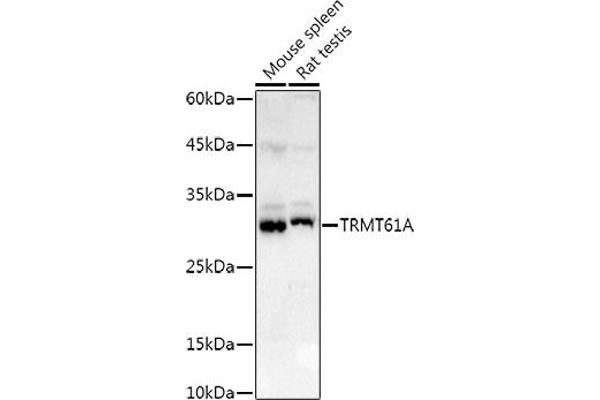 TRMT61A antibody  (AA 1-289)