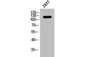 Western Blot analysis of 293T cells using Phospho-p120 (Y228) Polyclonal Antibody (CTNND1 antibody  (pTyr228))