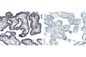 Immunohistochemistry (IHC) image for anti-Receptor Tyrosine-Protein Kinase ErbB-3 (ERBB3) antibody (ABIN967437) (ERBB3 antibody)