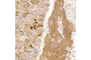 Immunohistochemistry of paraffin-embedded mouse adrenal gland using AGRP Rabbit pAb (ABIN7265515) at dilution of 1:50 (40x lens). (AGRP antibody  (AA 21-132))