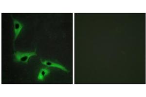 Immunofluorescence analysis of HeLa cells, using TSPAN8 antibody. (Tspan-8 antibody  (Internal Region))