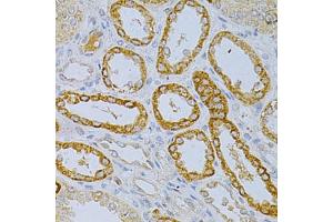 Immunohistochemistry of paraffin-embedded human kidney using OLR1 Antibody. (OLR1 antibody)