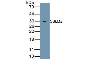 Detection of Recombinant GSK3b, Human using Polyclonal Antibody to Glycogen Synthase Kinase 3 Beta (GSK3b) (GSK3 beta antibody  (AA 122-375))