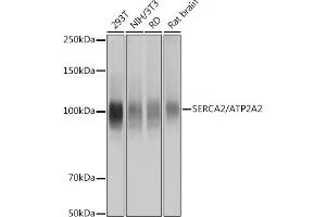 Western blot analysis of extracts of various cell lines, using SERC/ Rabbit mAb (ABIN7265753) at 1:1000 dilution. (ATP2A2 antibody)