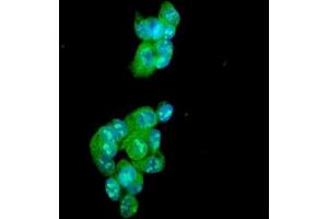 IF analysis of Ataxin 1 using anti-Ataxin 1 antibody (ABIN3043506). (Ataxin 1 antibody  (C-Term))
