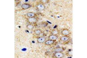 Immunohistochemical analysis of IGFBP5 staining in mouse brain formalin fixed paraffin embedded tissue section.
