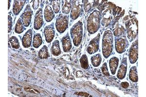 Immunohistochemistry (IHC) image for anti-CD2-Associated Protein (Cd2ap) antibody (ABIN2856284)