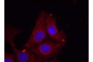Immunofluorescence staining of methanol-fixed HeLa cells using GAP43 (Phospho-Ser41) Antibody (E011281, Red) (GAP43 antibody  (pSer41))