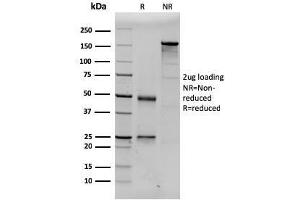 SDS-PAGE Analysis Purified Prolactin Mouse Monoclonal Antibody (PRL/2643). (Prolactin antibody  (AA 63-201))