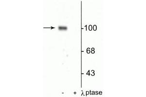 Western blot of rat hippocampal lysate showing specific immunolabeling of the ~100 kDa GluR1 protein phosphorylated at Ser845 in the first lane (-).