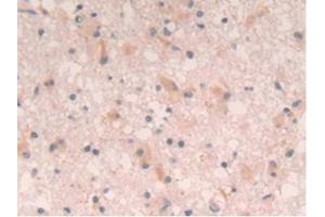 Figure. (IL-4 antibody  (AA 25-153))