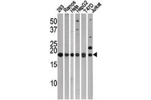Western Blotting (WB) image for anti-Microtubule-Associated Protein 1 Light Chain 3 gamma (MAP1LC3C) (AA 1-30) antibody (ABIN3031793)