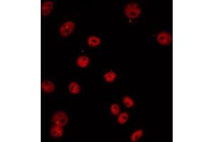 ABIN6274685 staining COLO205 by IF/ICC. (TCEB3C antibody  (Internal Region))
