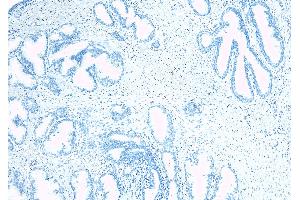 ABIN334520 Negative Control showing staining of paraffin embedded Human Prostate, with no primary antibody. (TUSC3 antibody  (Internal Region))