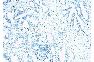ABIN334520 Negative Control showing staining of paraffin embedded Human Prostate, with no primary antibody.
