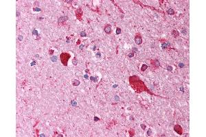 Anti-FOXI1 antibody IHC of human brain, cortex. (FOXI1 antibody  (AA 221-270))