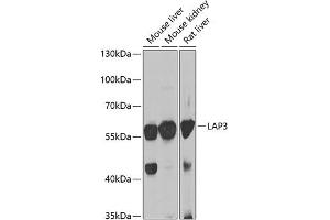 Western blot analysis of extracts of various cell lines, using L antibody (ABIN6131434, ABIN6143087, ABIN6143088 and ABIN6222907) at 1:1000 dilution. (LAP3 antibody  (AA 260-519))