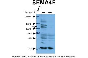 human cell line A431 Primary antibody dilution and incubation time:1:600, 4 degree overnightSecondary antibody used and dilution and incubation time: 1:3000, RT 2 hours (SEMA4F antibody  (N-Term))