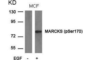 Western blot analysis of extracts from MCF cells untreated or treated with EGF using MARCKS(phospho-Ser170) Antibody. (MARCKS antibody  (pSer170))