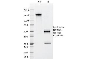 SDS-PAGE Analysis Purified CD79b Mouse Monoclonal Antibody (IGB/1842). (CD79b antibody  (AA 29-159))