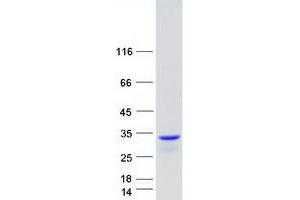 Validation with Western Blot (EXOSC5 Protein (Myc-DYKDDDDK Tag))