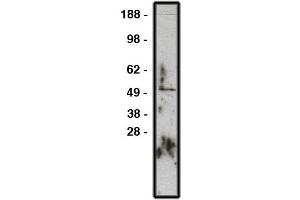Western blot using GLI1 antibody , used  at 1:200k dilution.