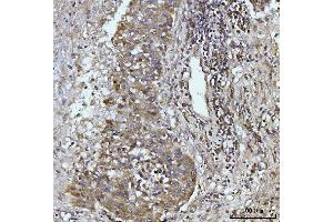 IHC analysis of Glutaminase/GLS using anti-Glutaminase/GLS antibody (ABIN7601602). (Glutaminase antibody  (AA 396-654))