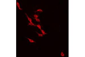 ABIN6274238 staining NIH-3T3 by IF/ICC. (Recoverin antibody  (Internal Region))