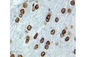 Used in DAB staining on fromalin fixed paraffin-embedded Brain tissue (EBF2 antibody  (AA 285-536))
