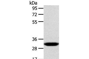 Western Blot analysis of Human fetal liver tissue using CCS Polyclonal Antibody at dilution of 1:300 (Superoxide dismutase copper chaperone antibody)