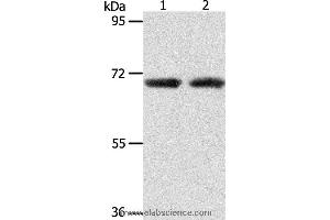 Western blot analysis of Human liver cancer and fetal kidney tissue, using ACOT11 Polyclonal Antibody at dilution of 1:650