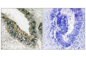 Immunohistochemistry (IHC) image for anti-Eukaryotic Translation Initiation Factor 2-alpha Kinase 3 (EIF2AK3) (Thr981) antibody (ABIN1848259) (PERK antibody  (Thr981))