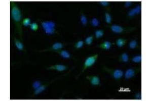 Immunostaining analysis in HeLa cells. (KIF2C antibody)