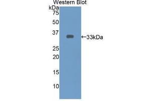 Western blot analysis of the recombinant protein. (ECE1 antibody  (AA 469-721))