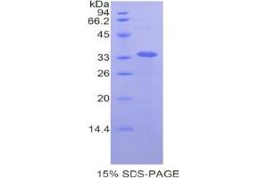 SDS-PAGE analysis of Human LOXL4 Protein. (LOXL4 Protein)