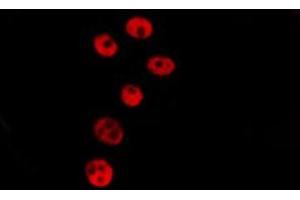 ABIN6279199 staining HepG2 by IF/ICC. (BSX antibody  (C-Term))