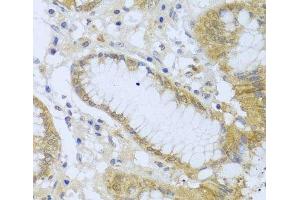 Immunohistochemistry of paraffin-embedded Human stomach using ACP1 Polyclonal Antibody at dilution of 1:100 (40x lens). (ACP1 antibody)