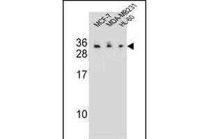C1QL4 Antibody (N-term) (ABIN655459 and ABIN2844988) western blot analysis in MCF-7,MDA-M,HL-60 cell line lysates (35 μg/lane). (C1QL4 antibody  (N-Term))