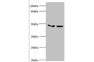 Western blot All lanes: Histone-lysine N-methyltransferase SMYD3 antibody at 3 μg/mL Lane 1: Hela whole cell lysate Lane 2: HepG2 whole cell lysate Secondary Goat polyclonal to rabbit IgG at 1/10000 dilution Predicted band size: 50, 30, 43 kDa Observed band size: 50 kDa (SMYD3 antibody  (AA 199-428))