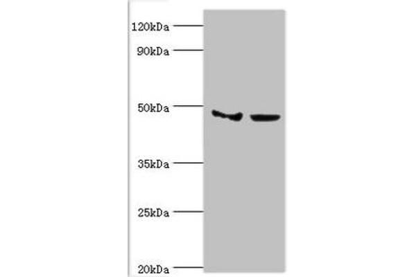 SMYD3 antibody  (AA 199-428)